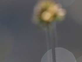 视物模糊 仅供参考 - 德轩津牙医诊所